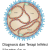 Diagnosis dan Terapi Infeksi Hantavirus